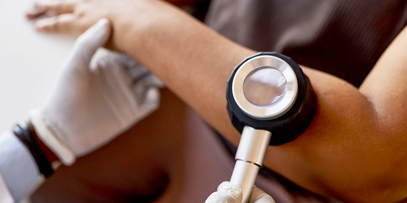 Cancer Skin Rash: What It Looks Like and When to See a Doctor