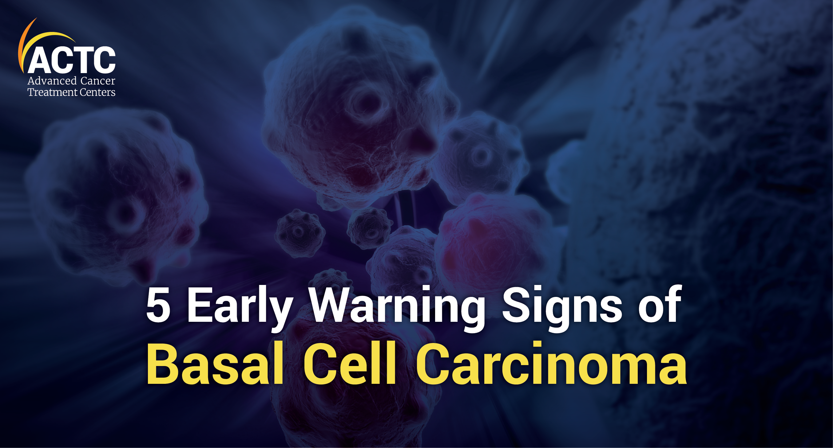  5 Early Warning Signs of  Basal Cell Carcinoma