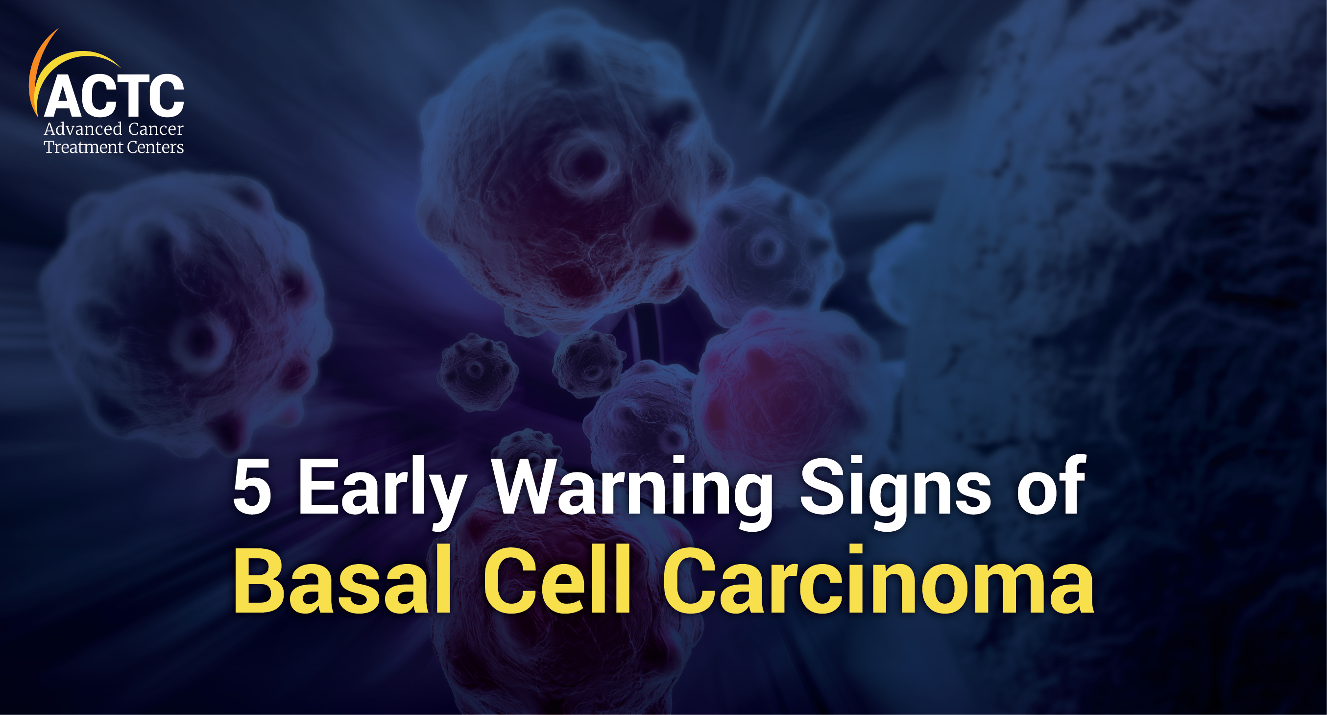 oral basal cell carcinoma