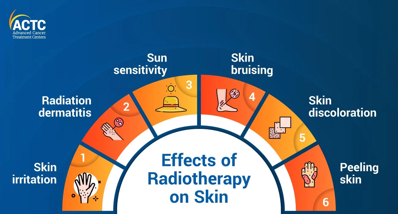 Effects of Radiotherapy on Skin