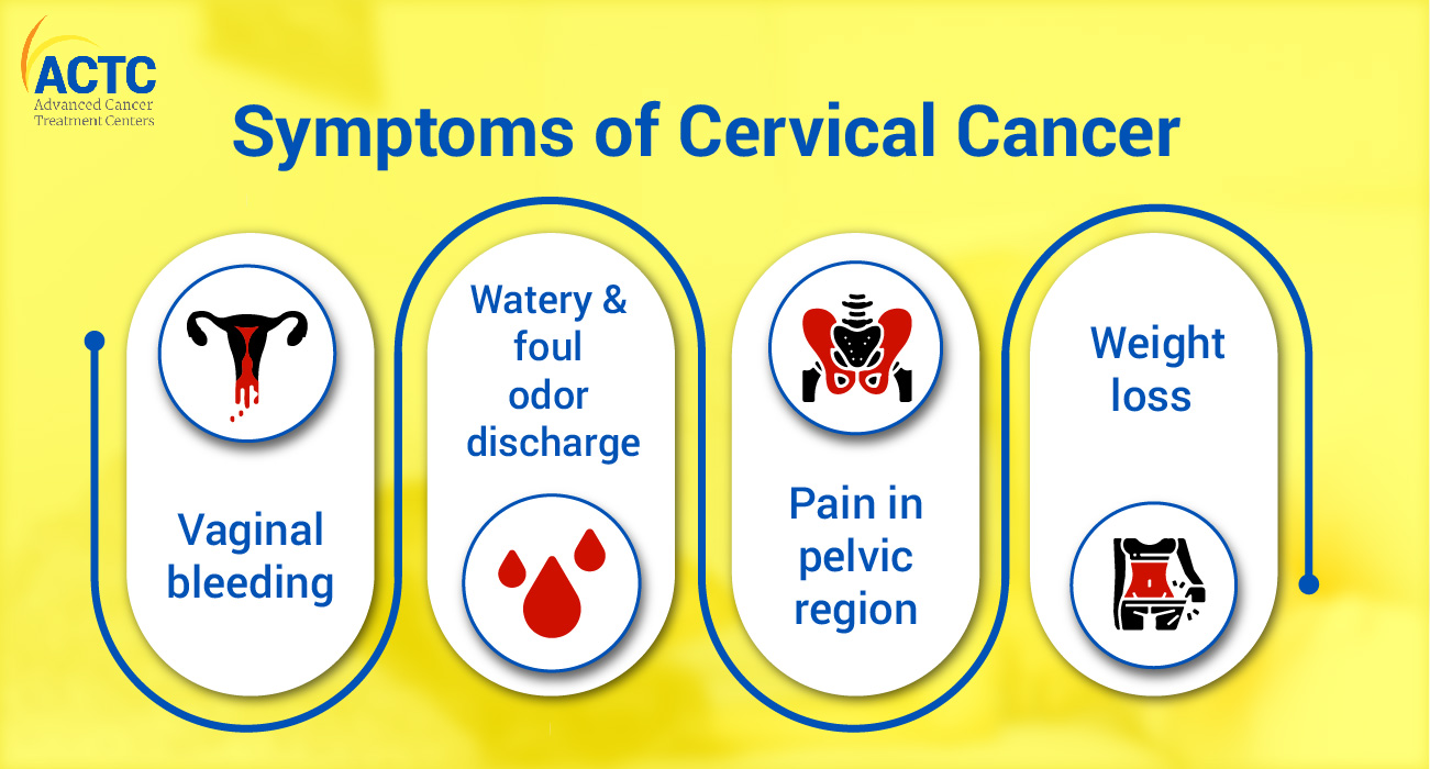 Cervical Cancer Causes Symptoms Stages Prevention - vrogue.co