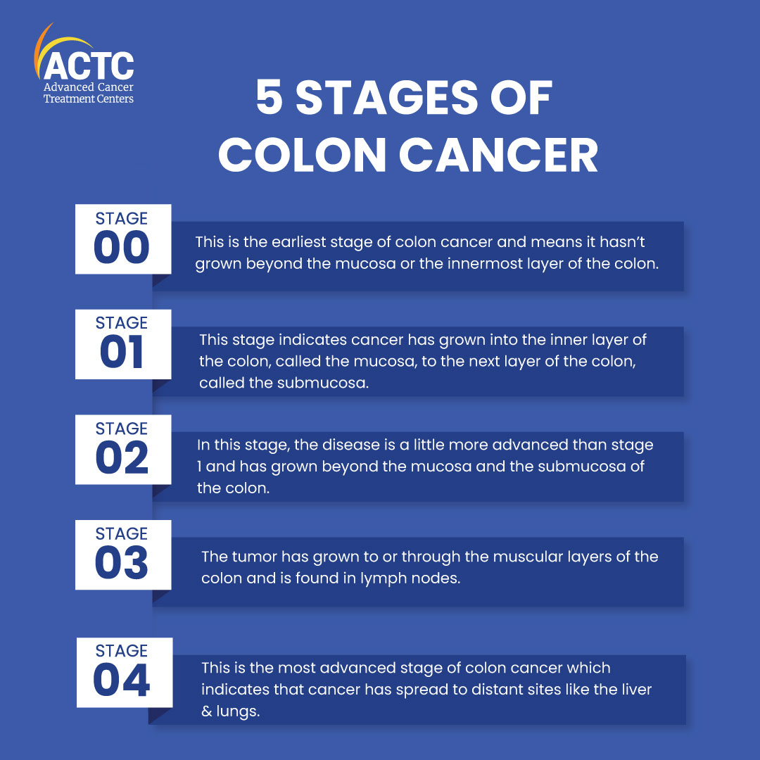 Understanding The 5 Stages Of Colon Cancer