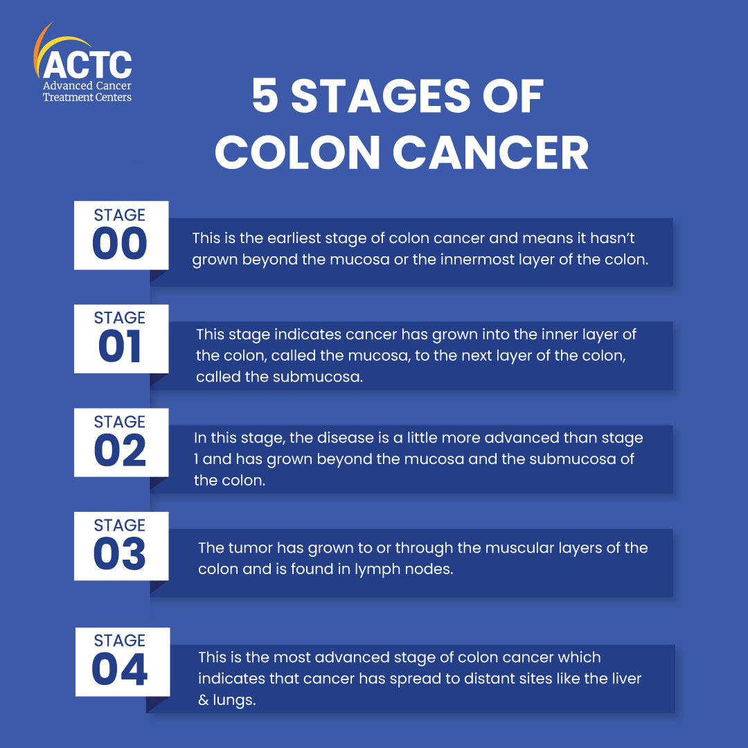 Stages of colon cancer and survival rates