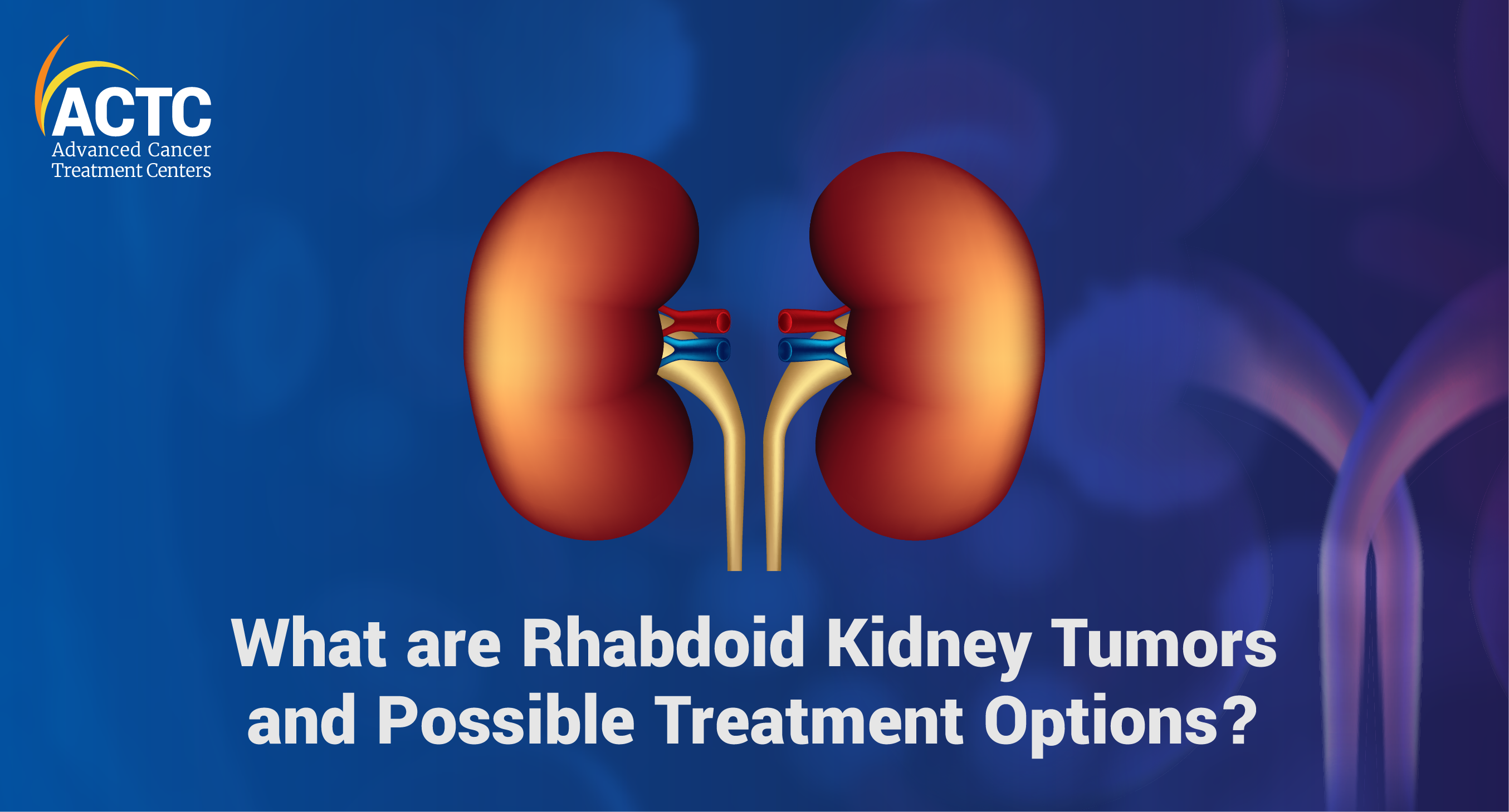 Rhabdoid Kidney Tumors: A Detailed Overview | ACTC