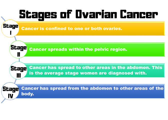 The Stages of Ovarian Cancer and What They Mean