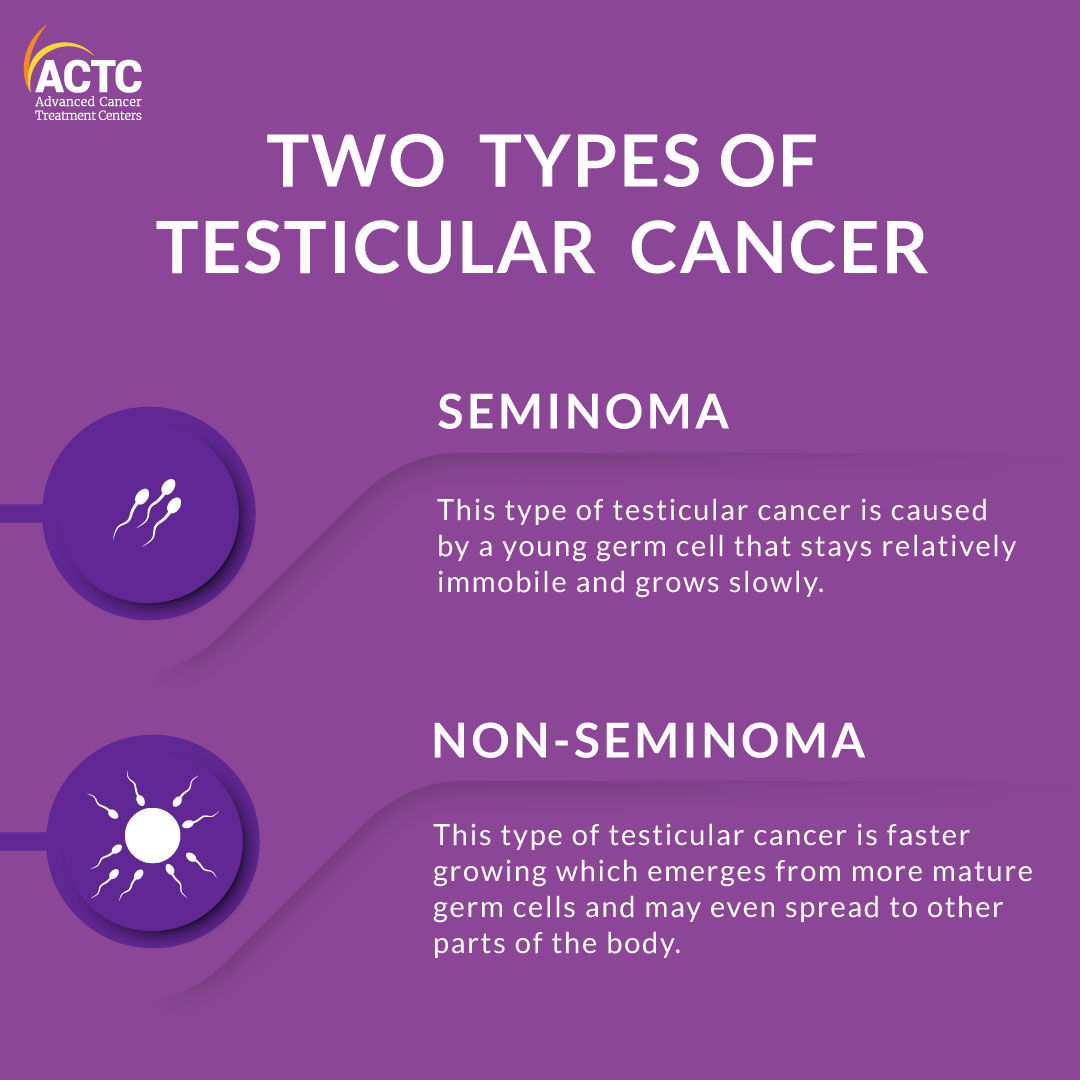 A Brief Guide To The Treatment Of Testicular Cancer ACTC Blog