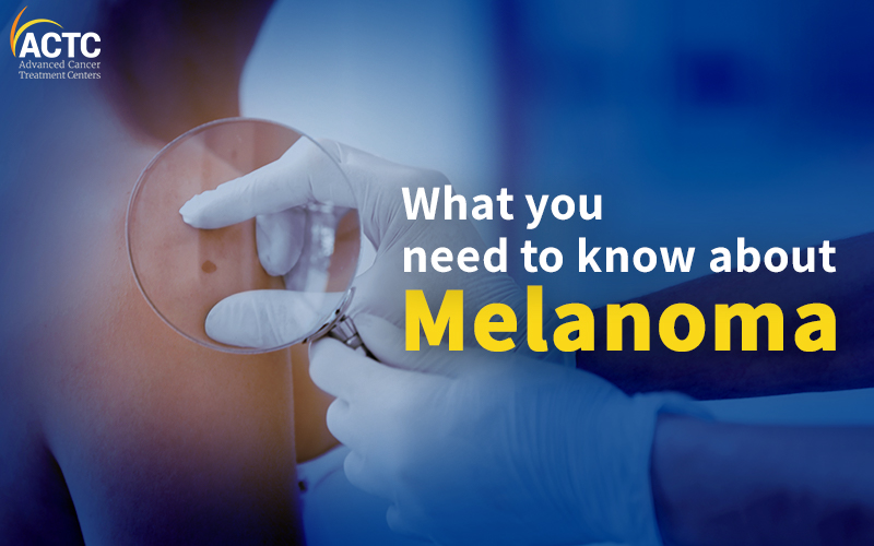What You Need to Know About Melanoma