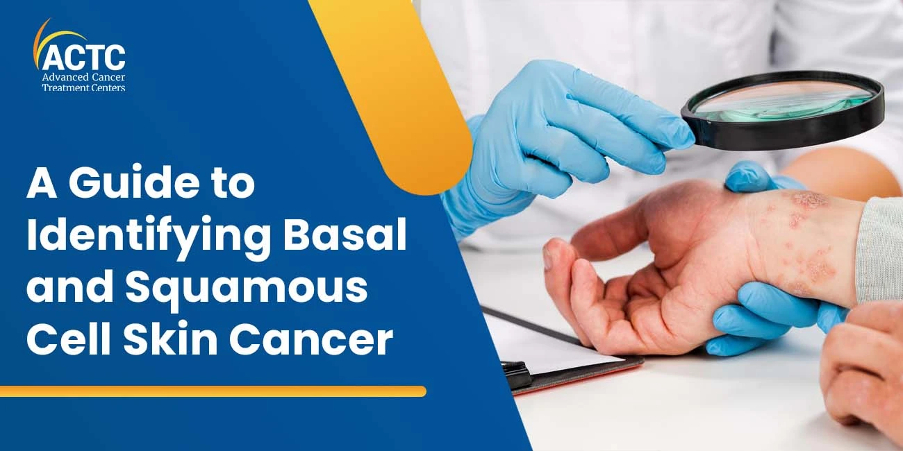A Guide to Identifying Basal and Squamous Cell Skin Cancer