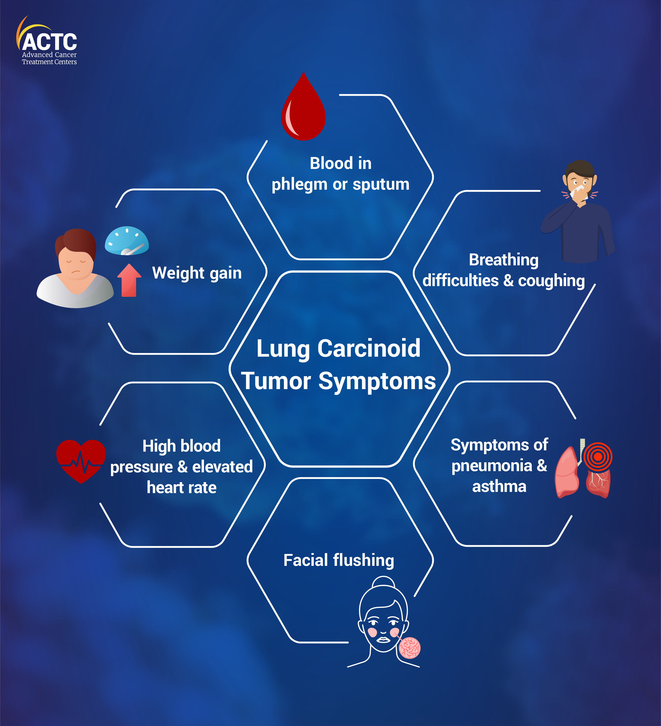 Lung Carcinoid Tumor Symptoms