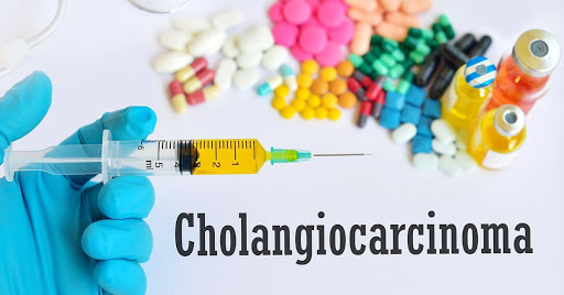 cholangiocarcinoma-knowing-the-basics-may-help-you-cope-better