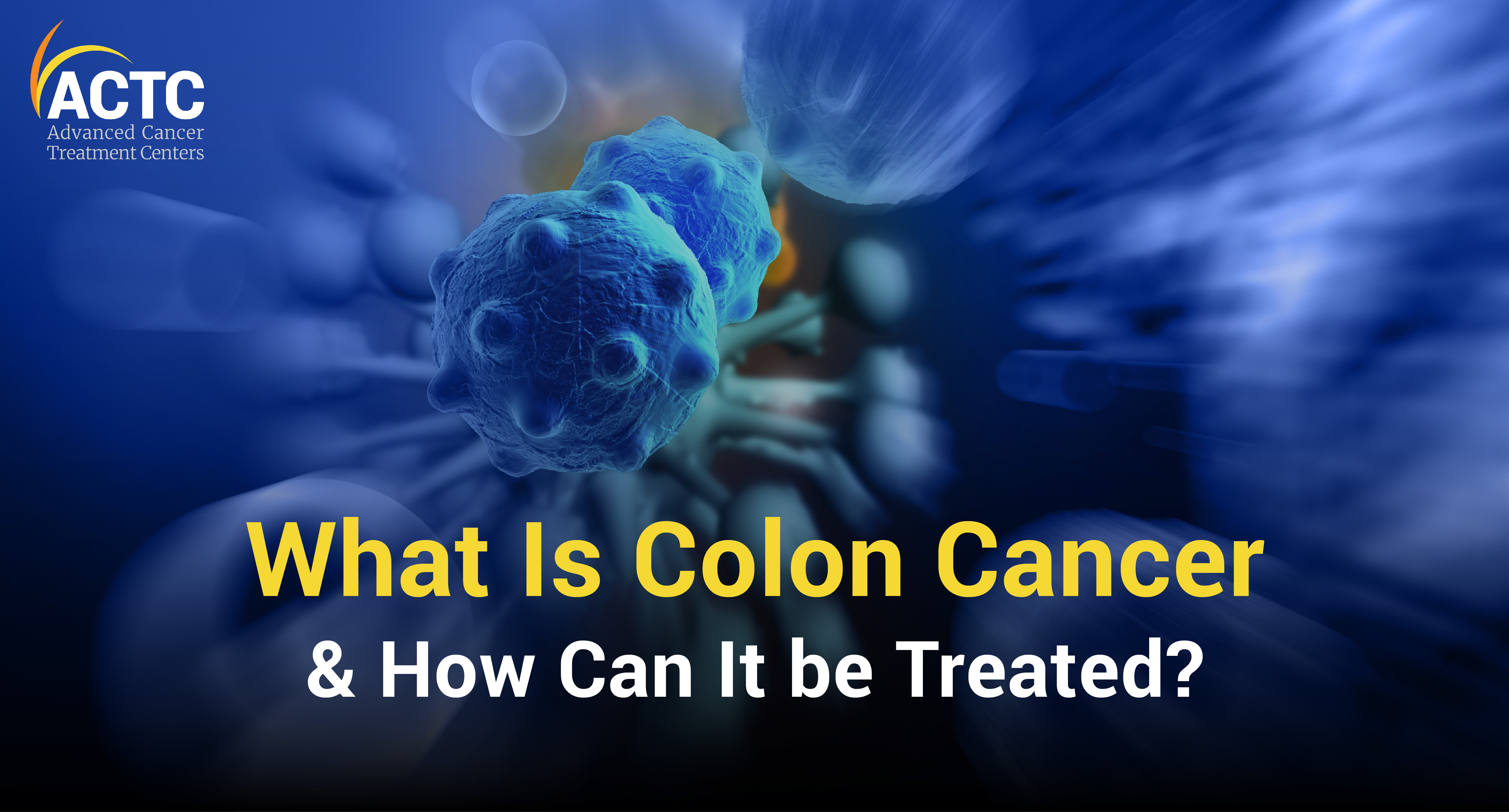 What Is Colon Cancer & How Can It Be Treated?