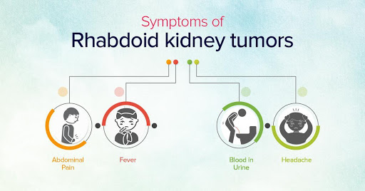 rhabdoid-kidney-tumors-a-greater-understanding-can-help-fight-them-better