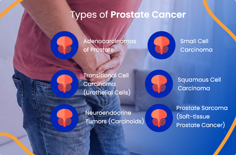 Are There Different Types Of Prostate Cancer