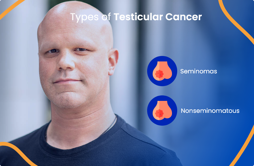 testicular-types