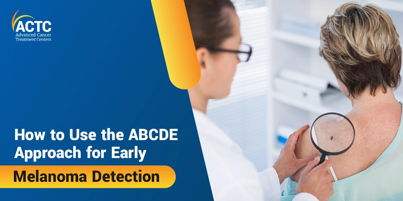 How to Use the ABCDE Approach for Early Melanoma Detection 