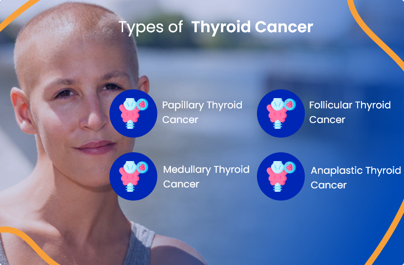 thyroid-types