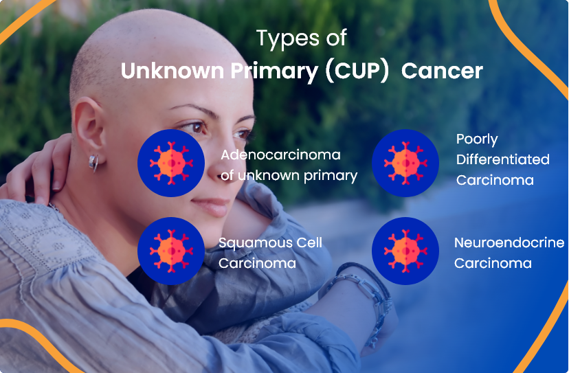 Unknown Primary Cancer Cup Everything You Need To Know