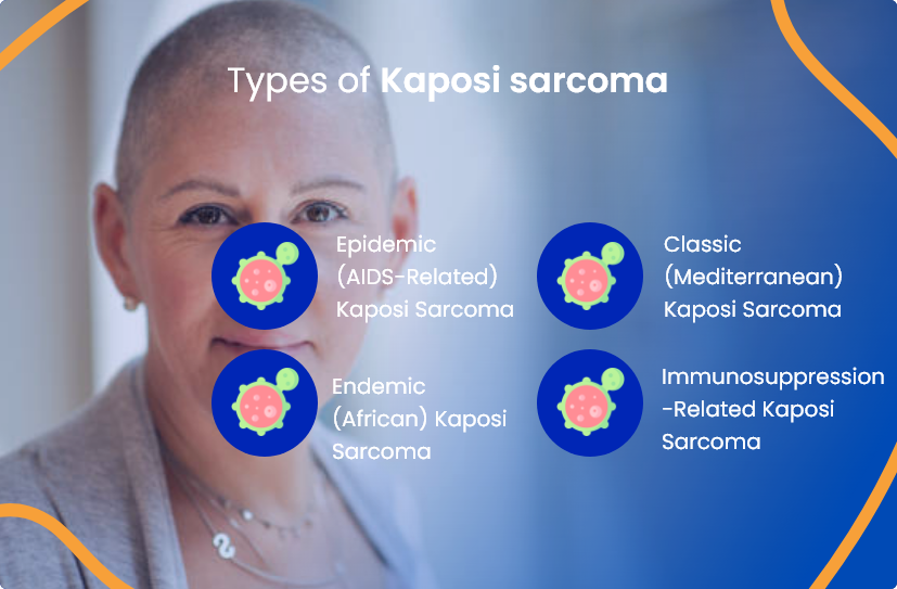 types-of-kaposi-sarcoma