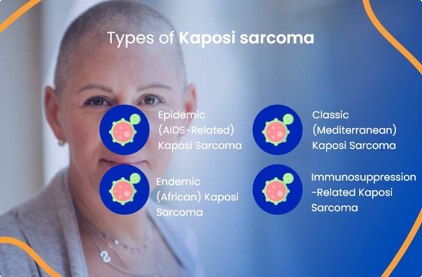 Kaposi Sarcoma Everything You Need To Know ACTC